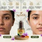 Kumkumadi Face Serum 20ml | Brightening & Glow Boosting Ayurvedic Oil