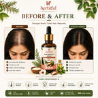 Hair Growth Serum 50ml | Rosemary, Bhringraj, Rice Water & Caffeine Hair Serum Supports Hair Growth, Stronger Roots & Healthier Looking Hair