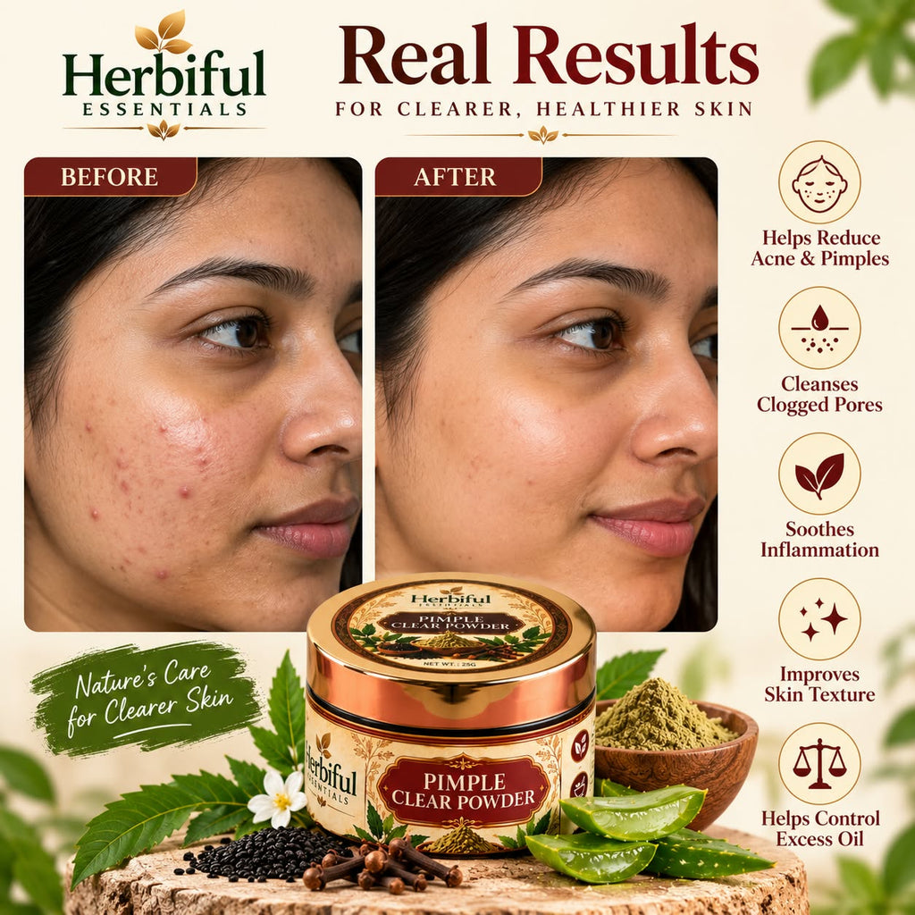 Herbiful Essentials Pimple Clear Powder | Herbal Acne & Blemish Care | 25g