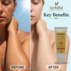 Sunscreen Lotion SPF 50+++ 50gm — Broad Spectrum UVA/UVB Protection with Ceramides & Vitamin B5